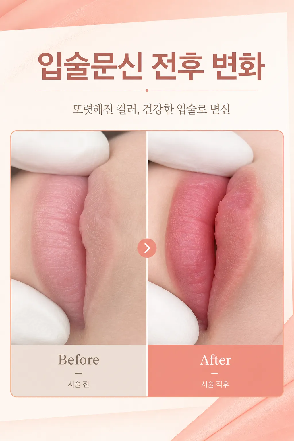 입술문신 시술 전후 입술 변화 비교 이미지