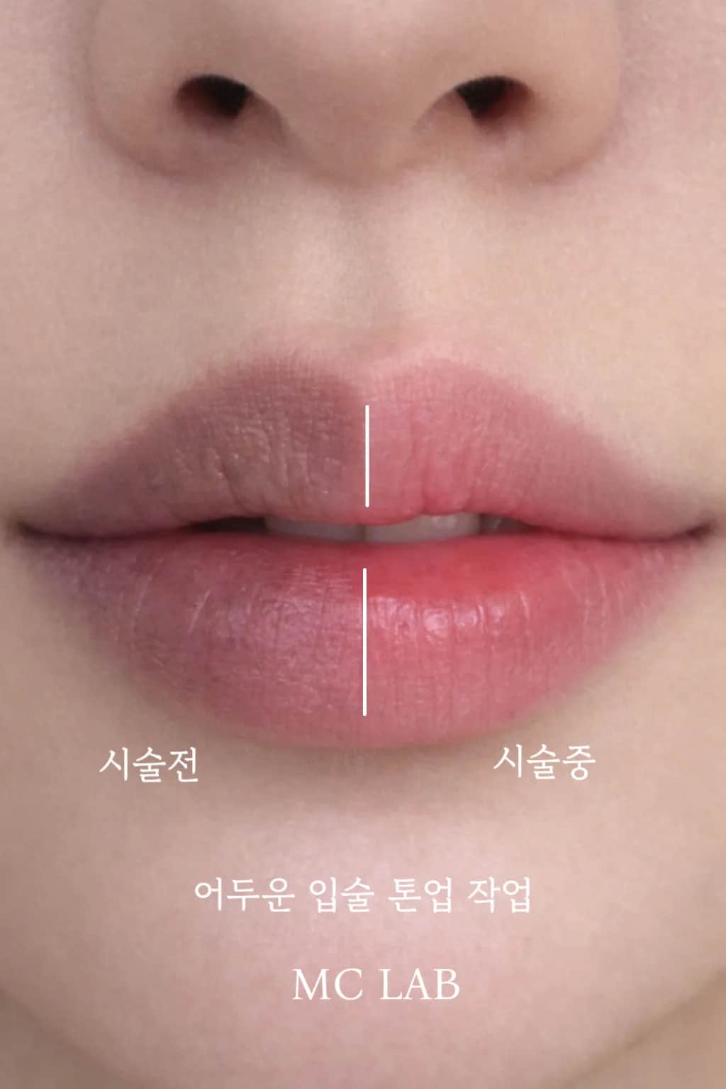 톤업 입술문신