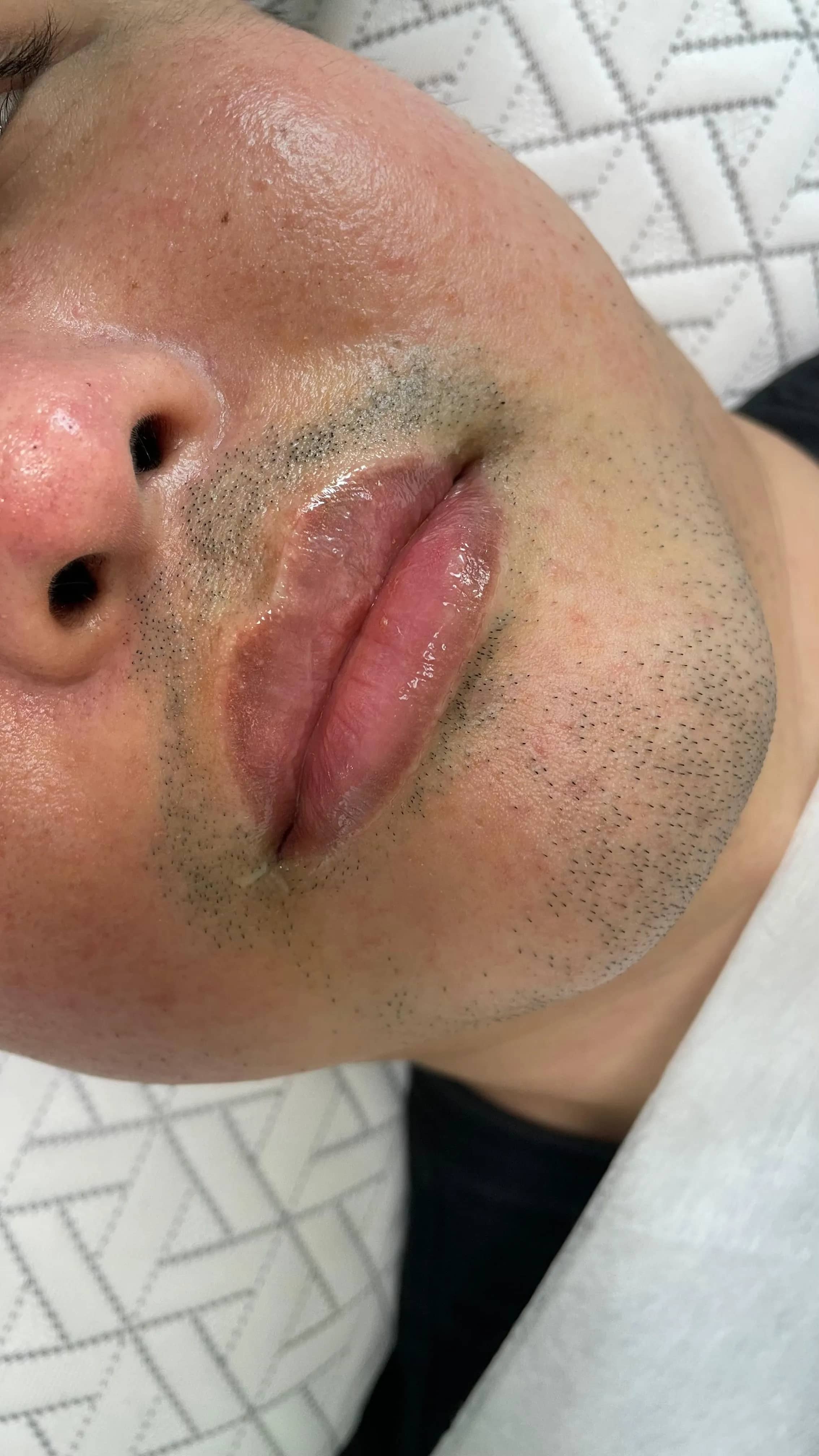 어두운 남자입술 톤업