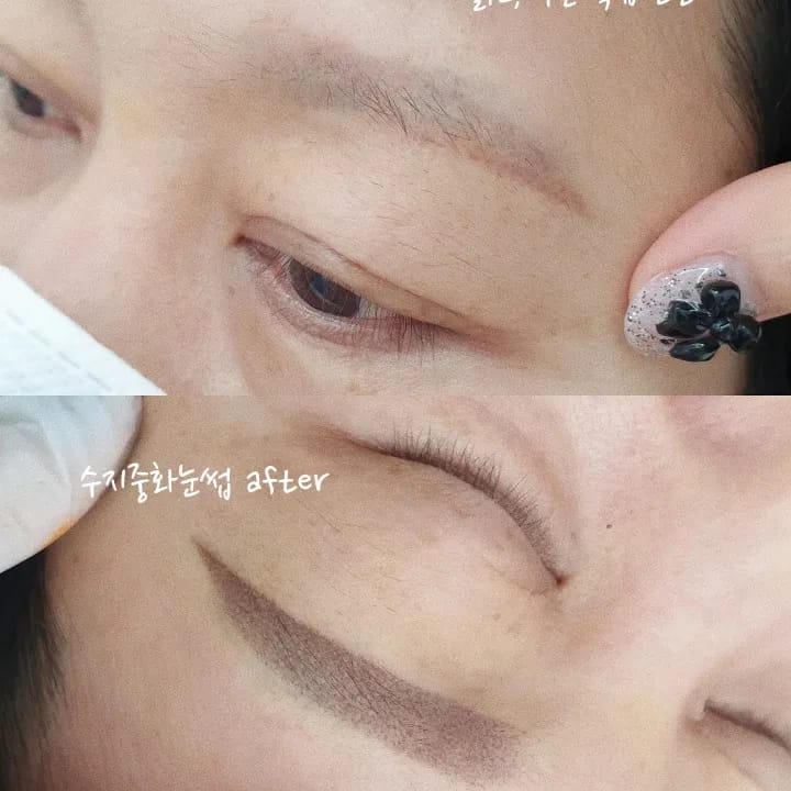 수지기법