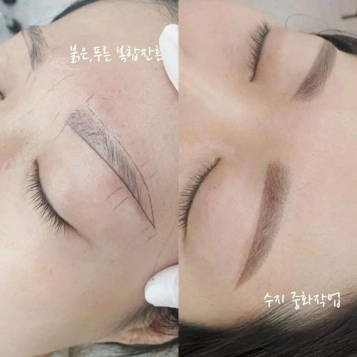 수지기법