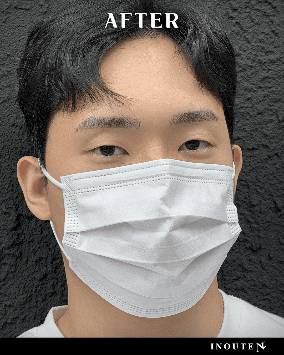 ๋ธ๋ก์ฐ ์ปจ์คํ
(B/A)