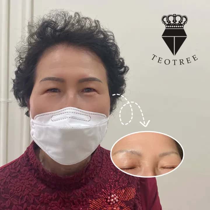 머신잔흔커버