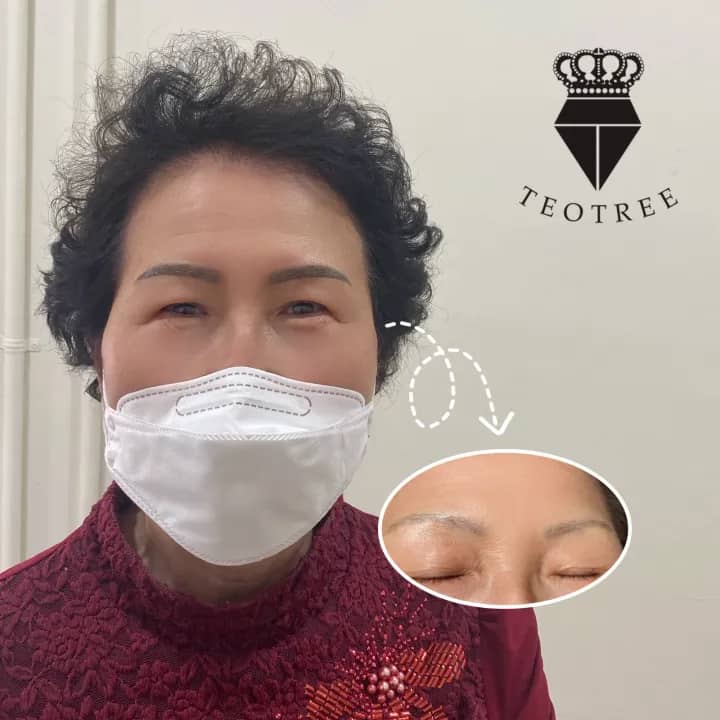 머신잔흔커버
