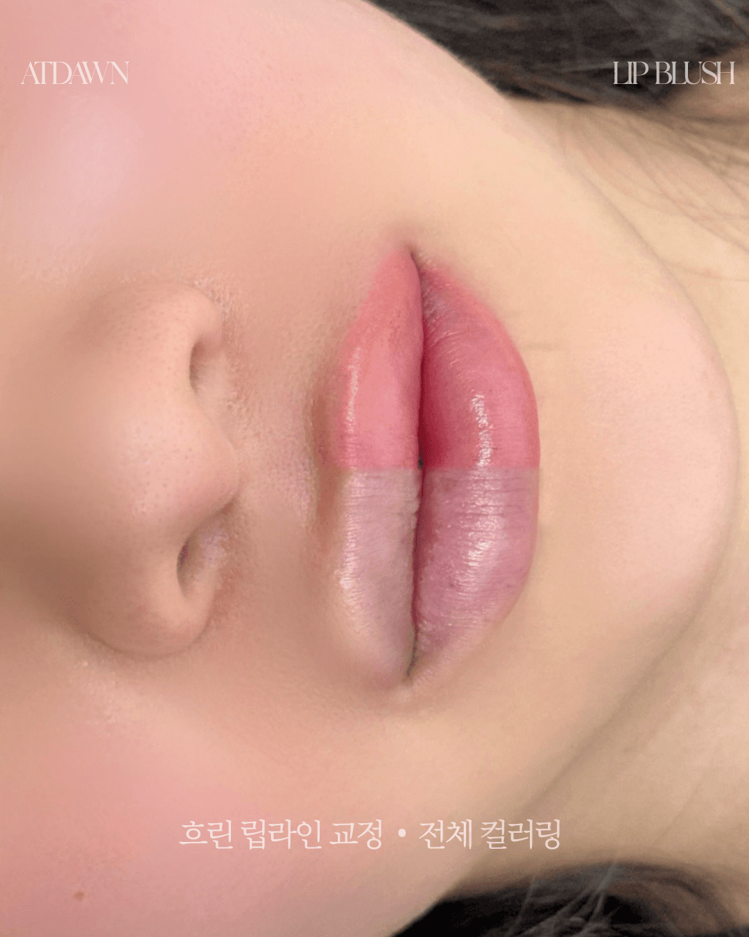 흐린 립라인 교정 | 풀 컬러링
