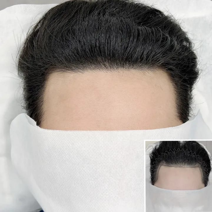 남자헤어라인커버업