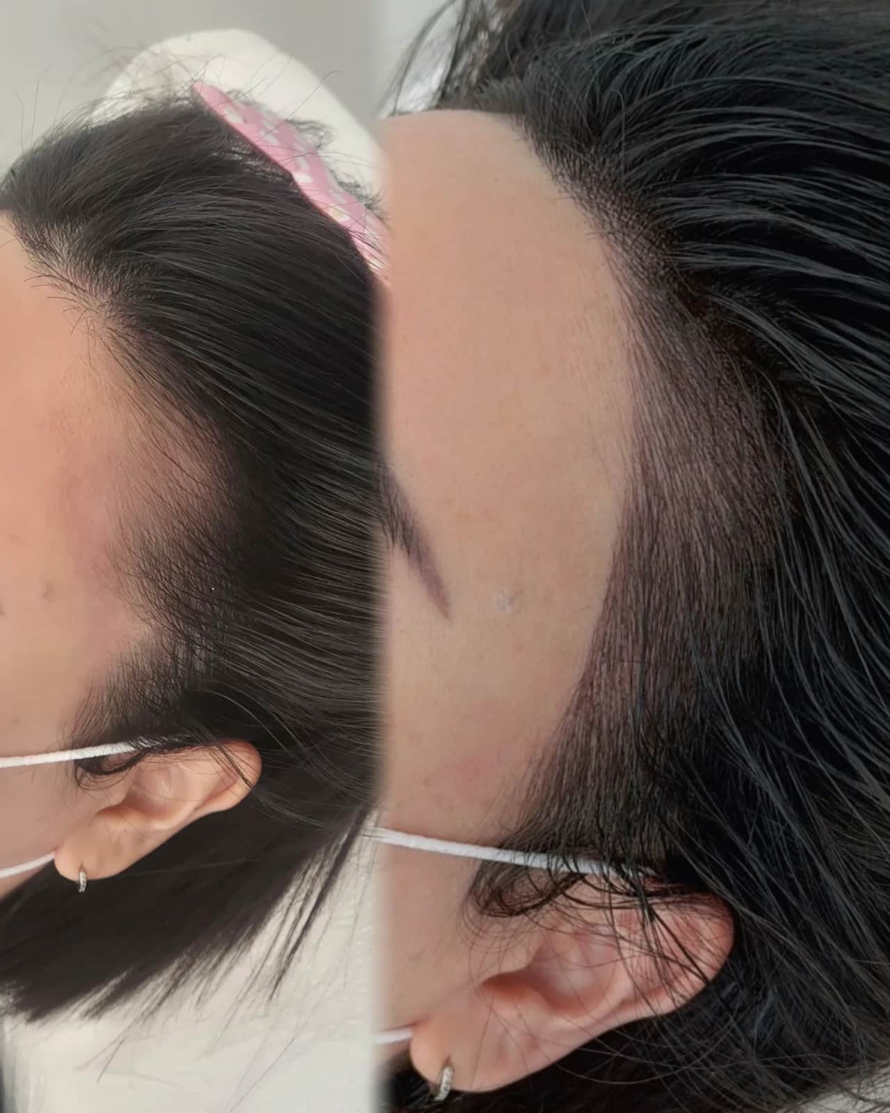 무브로우 결 헤어라인