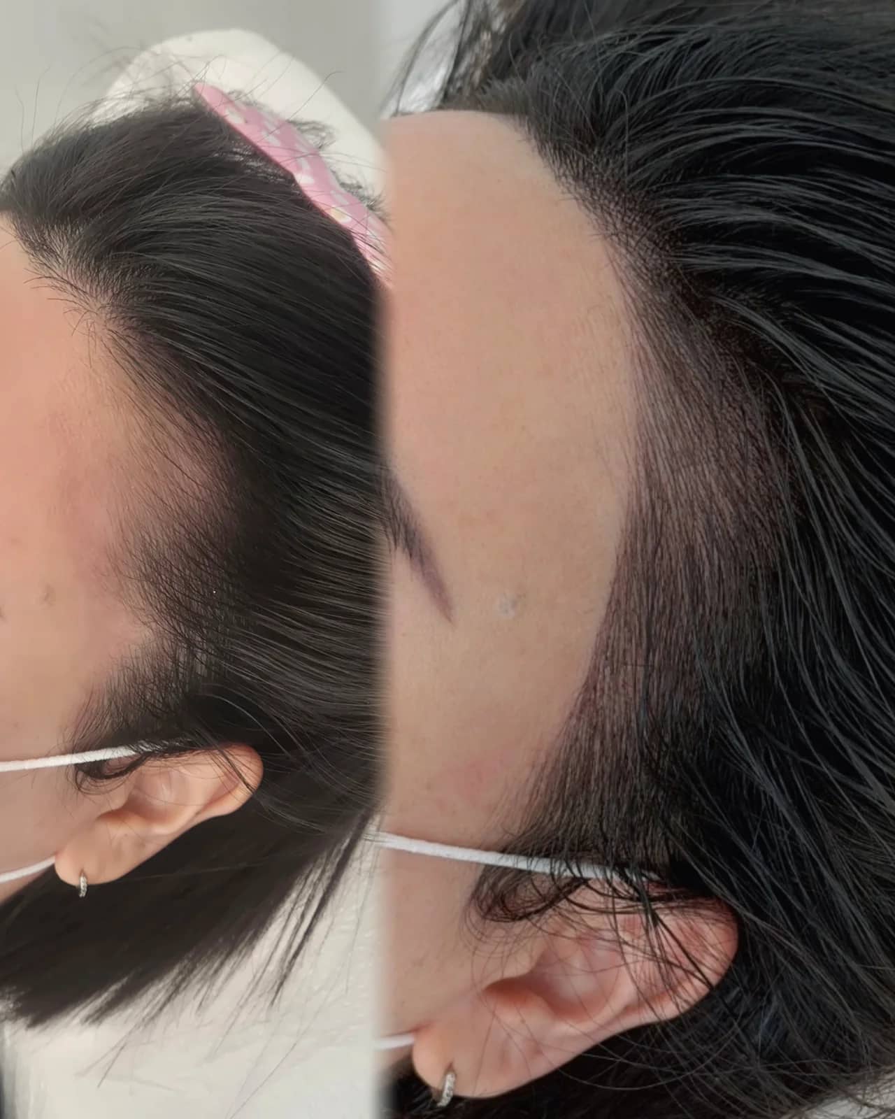 무브로우 결 헤어라인