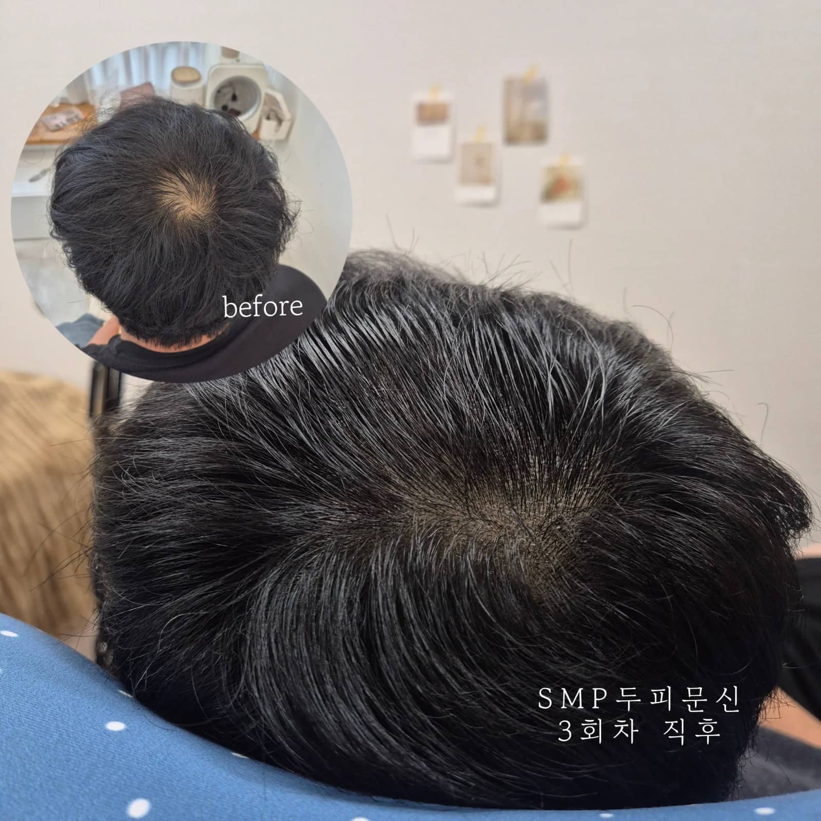 무브로우 SMP