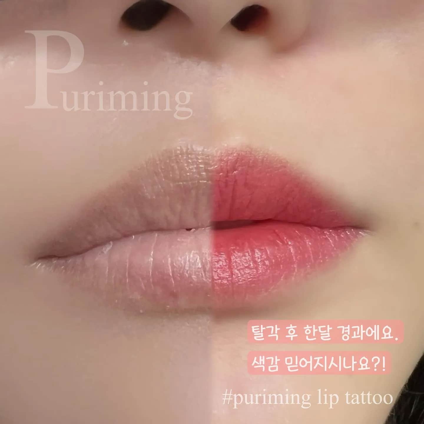 입술문신 하시기전에!! 탈각 후 사진이 있는지 꼭 확인하세요:) 사진 속 고객님은 탈각 후 한달 경과인데 색감 보이시나요?!✌️🥰