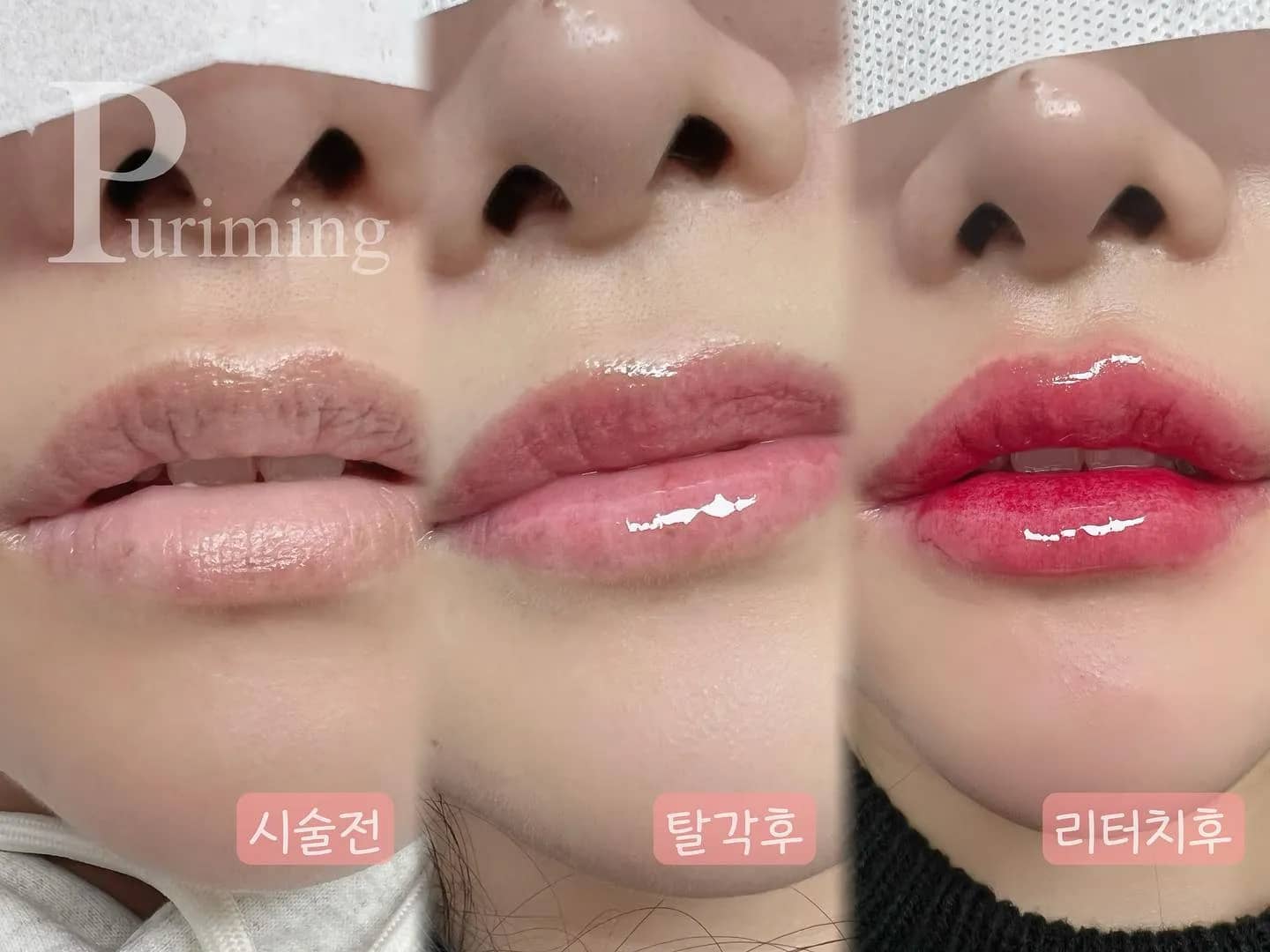 탈각 후 사진은 언제봐도 좋아용 :)
