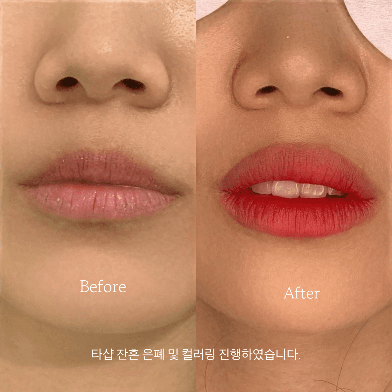 립틴트 1회 13만원