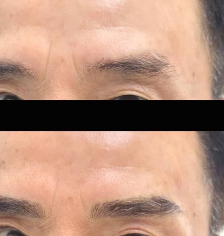 부분 눈썹