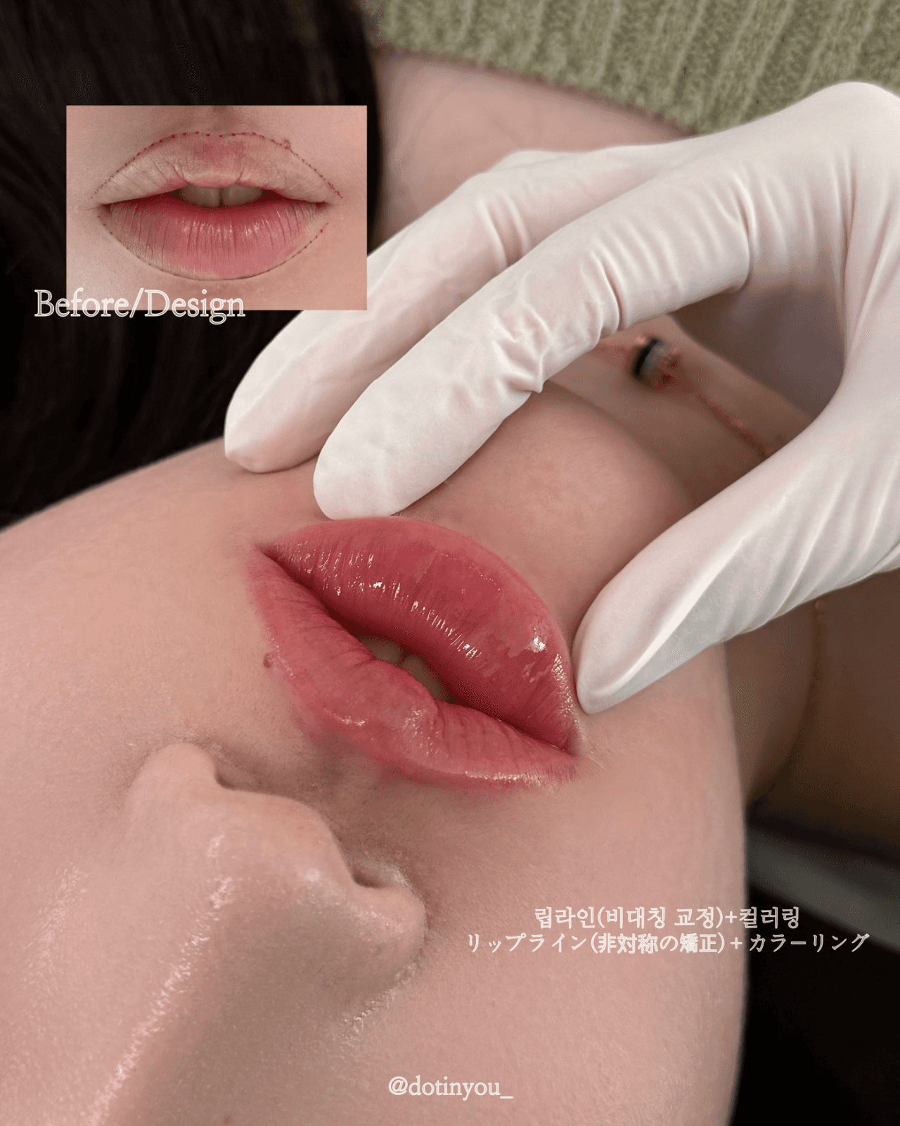 ์
์ ๋ฆฝ๋ผ์ธ+์ปฌ๋ฌ๋ง(๋น๋์นญ๊ต์ /ํดํธ๋ฆฝ)