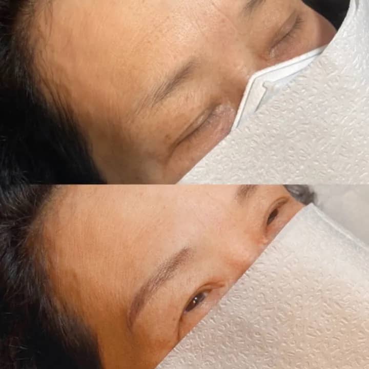 숱없는 여자눈썹