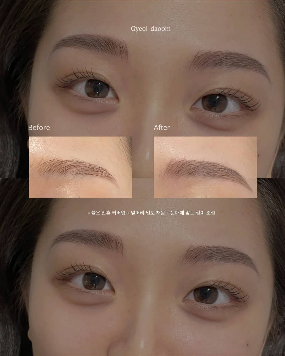잔흔으로 고민하지마세요🤦♀️