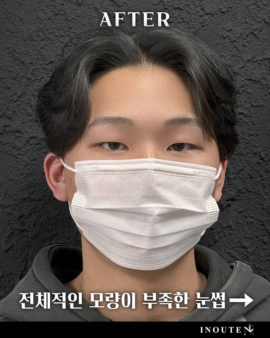 브로우 컨설팅(B/A)