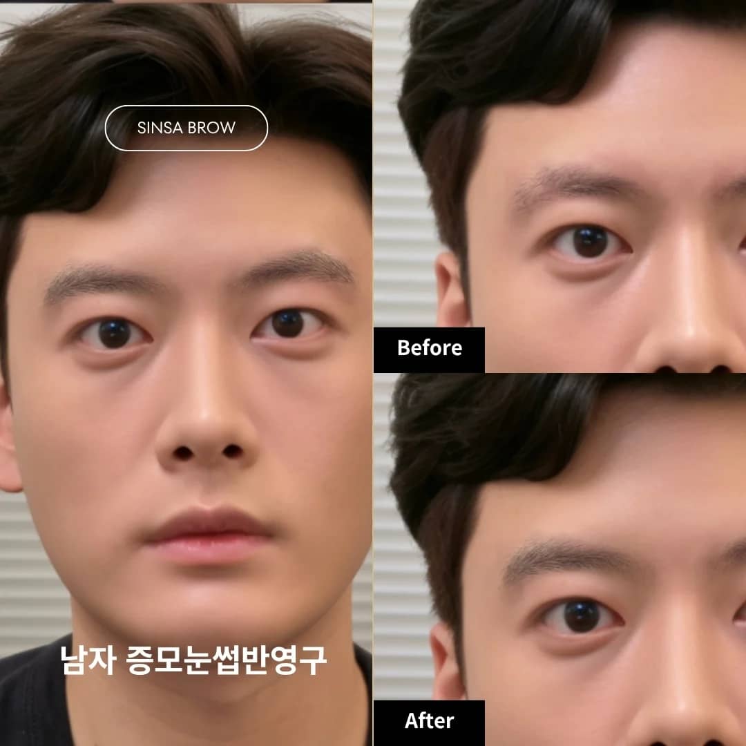 남자 증모눈썹 반영구