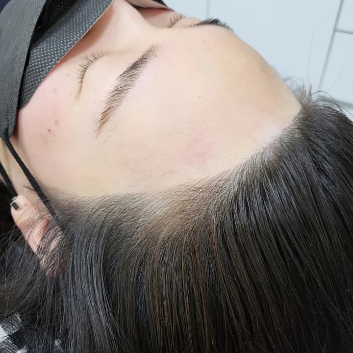 엠보 헤어라인 문신