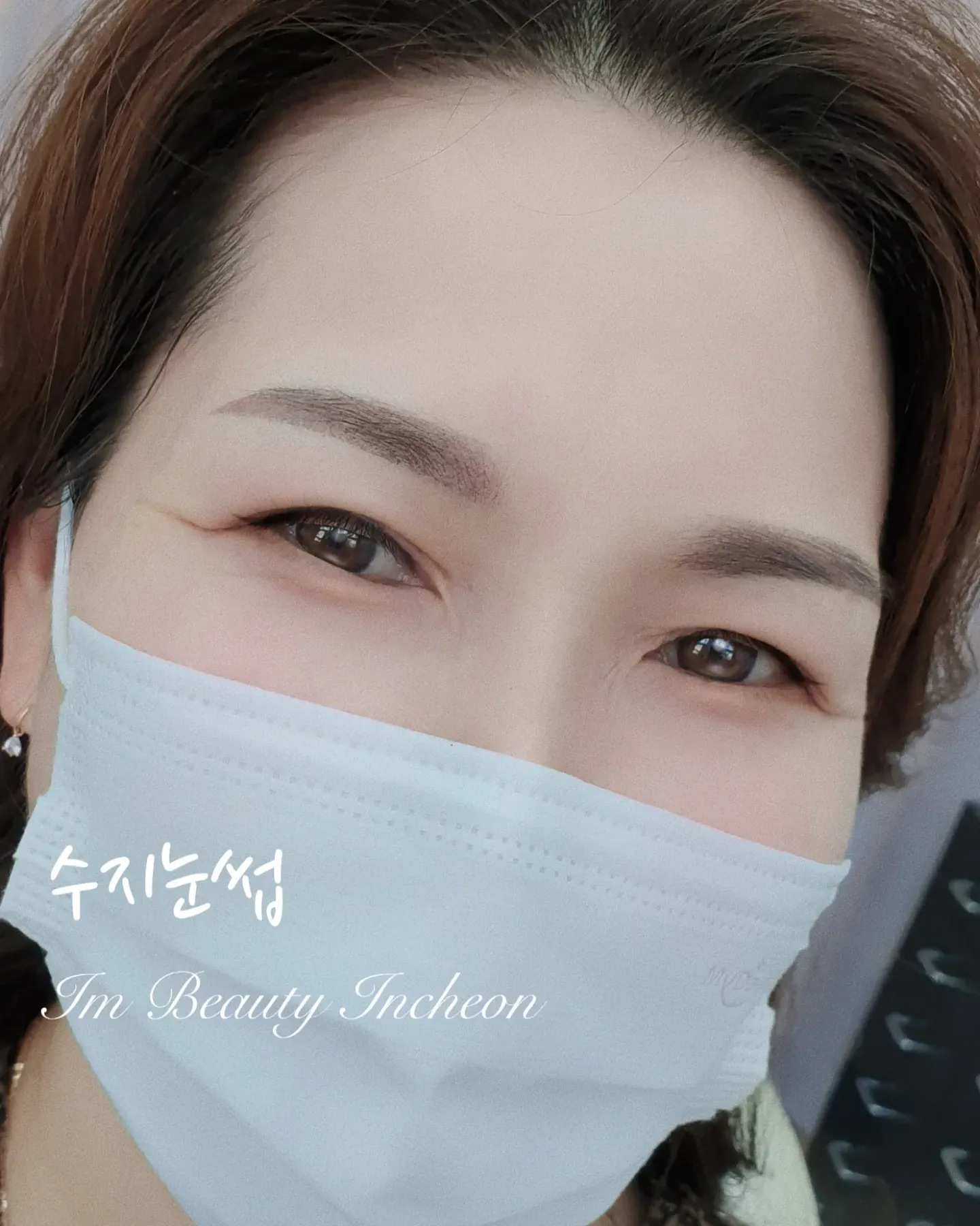 수지 기법