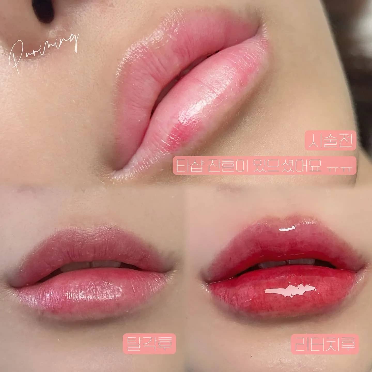 ⠀탈각후 색상 너무 이쁘게 물들었어요💛👍 리터치는 조금 더 진한 색상을 원하셔서 더 진하게 리터치 들어갔습니당 :)