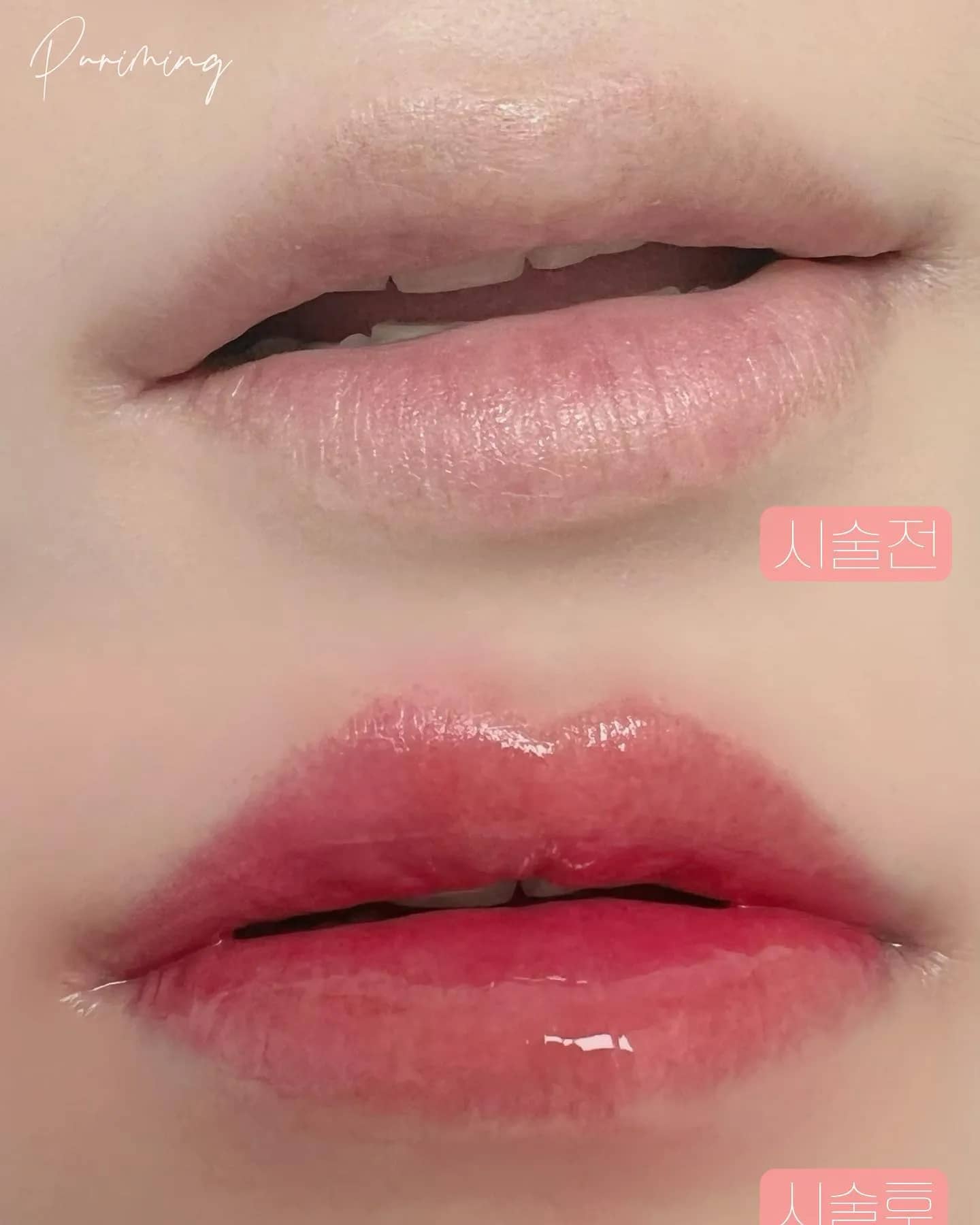 고객님의 니즈에 맞게 들어간 시술 전,후 사진 색감 이쁘죠?👍🥰