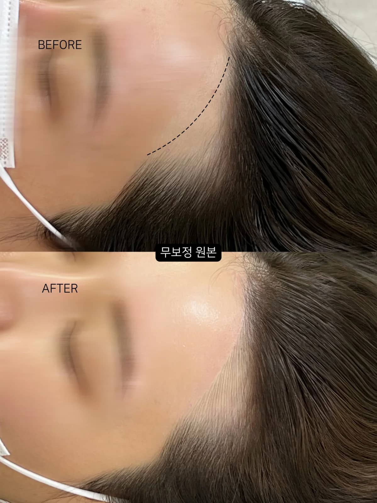 용산 헤어라인