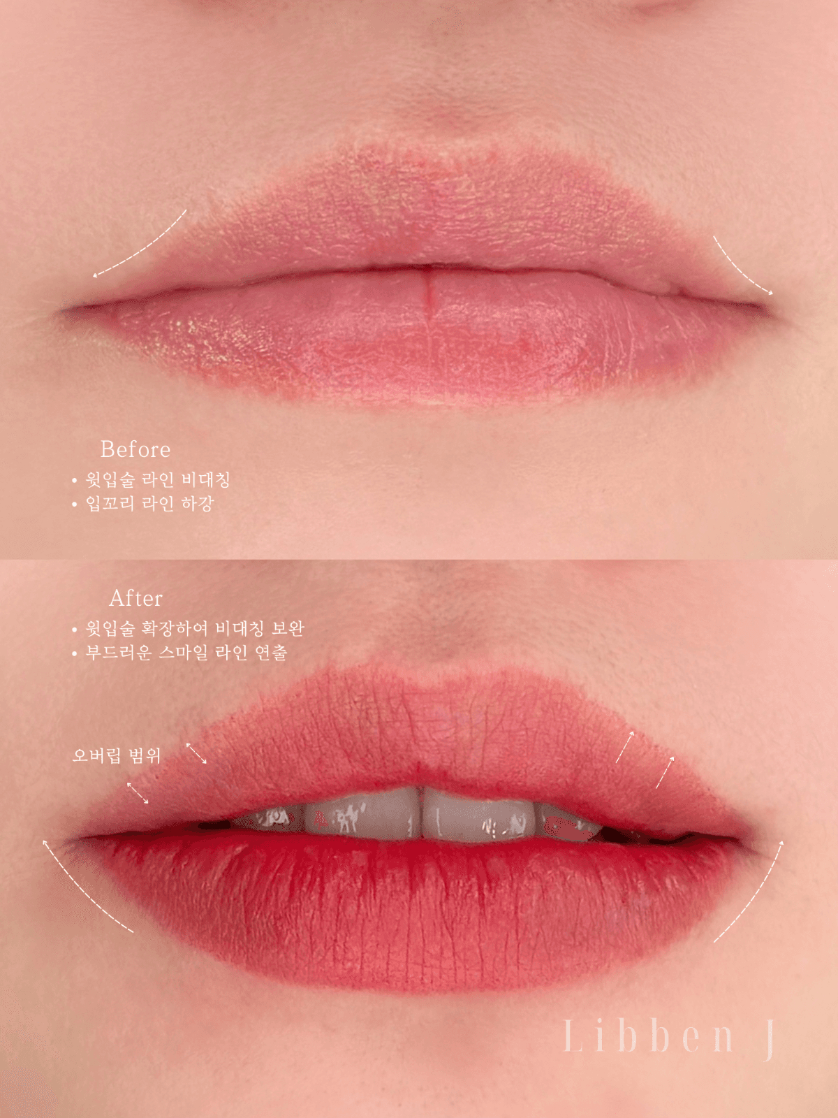 오버립+컬러