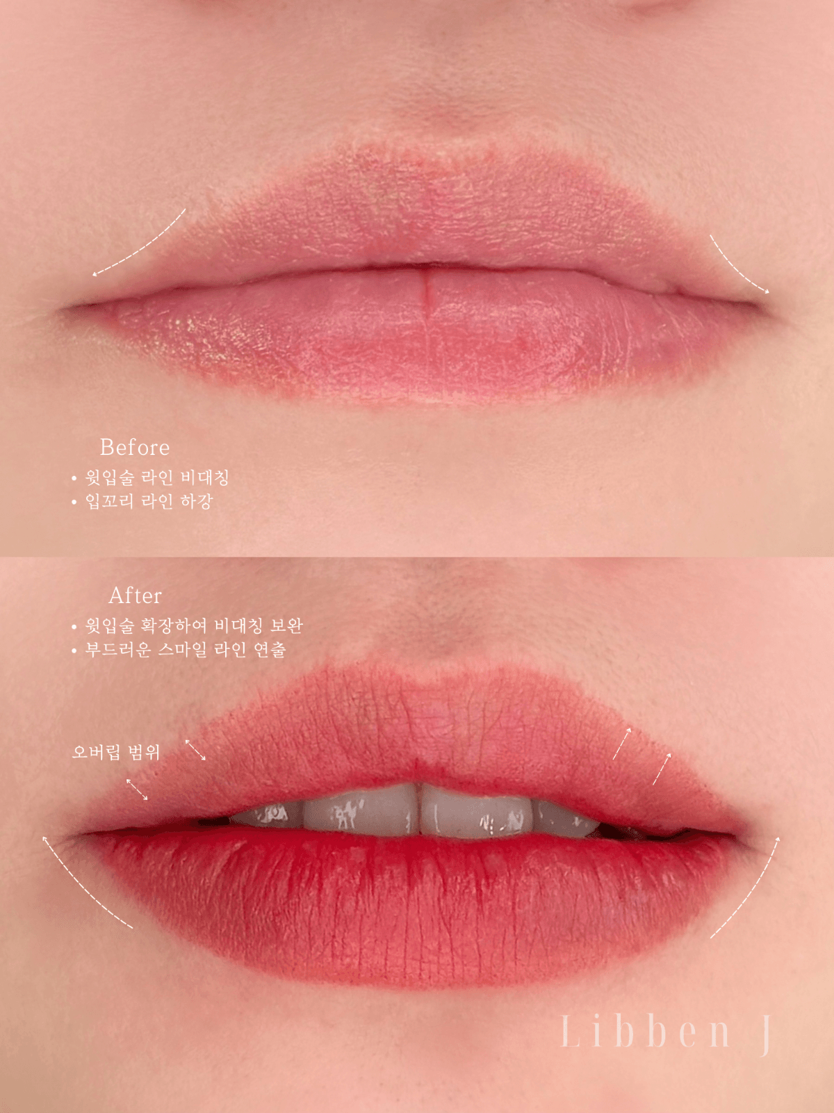 오버립+컬러