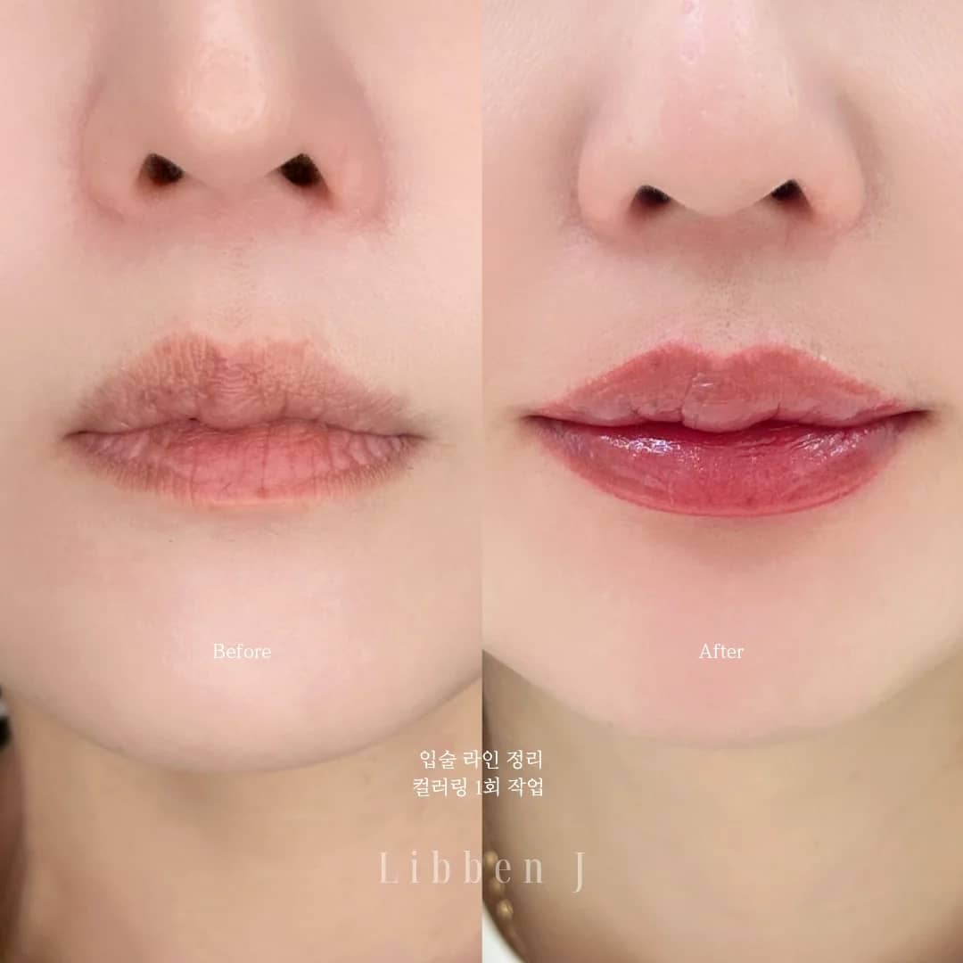 오버립+컬러