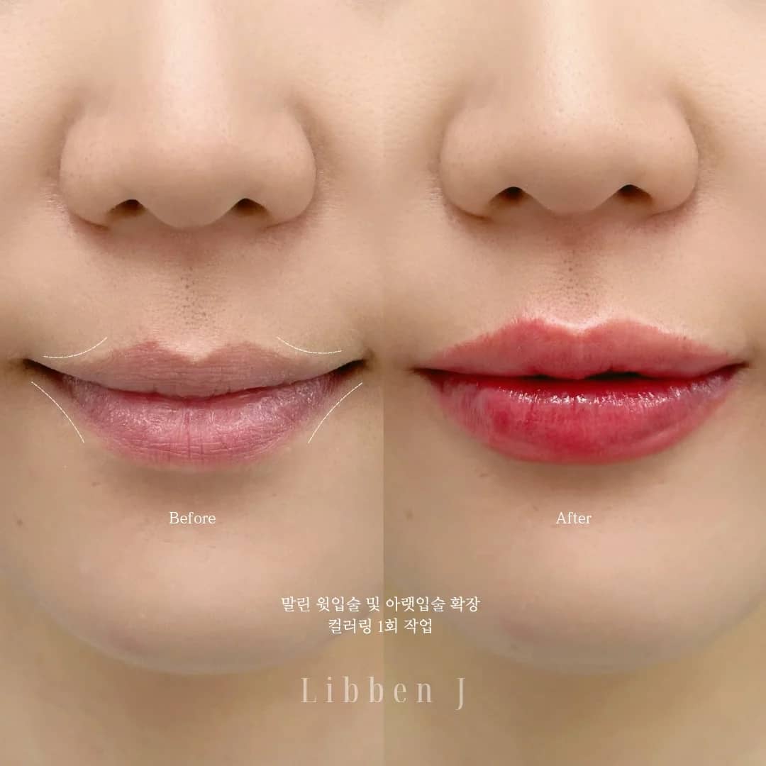 오버립+컬러