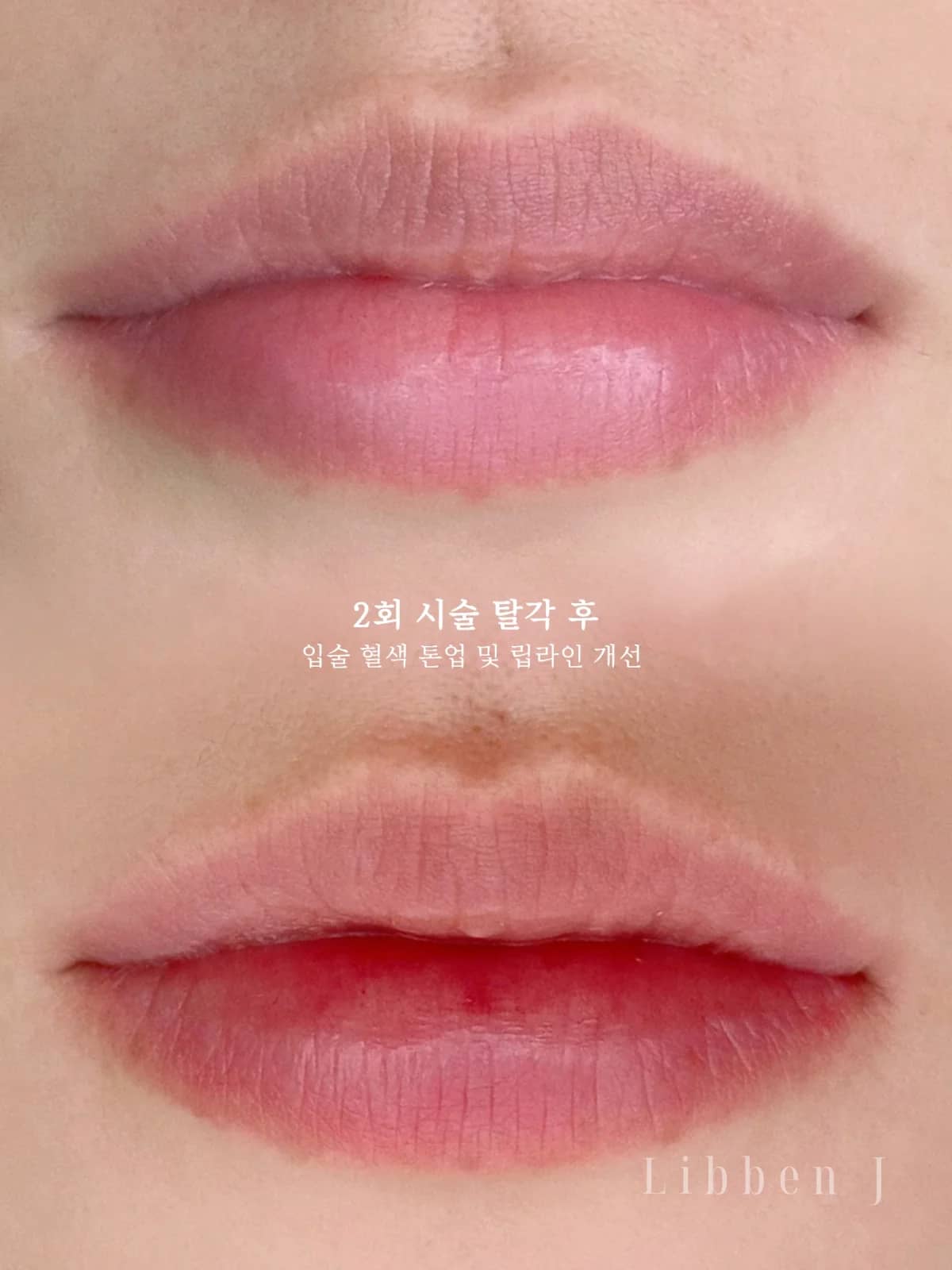 오버립+그라데이션 탈각후