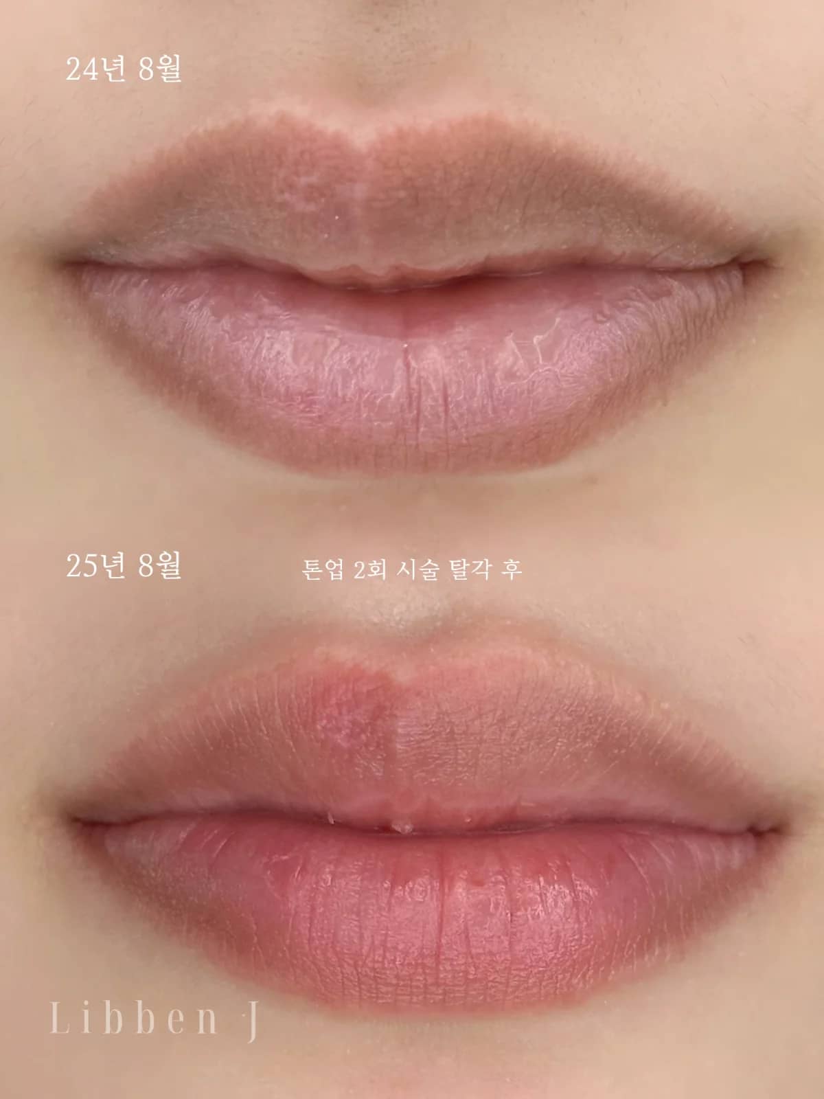 그라데이션립 탈각후