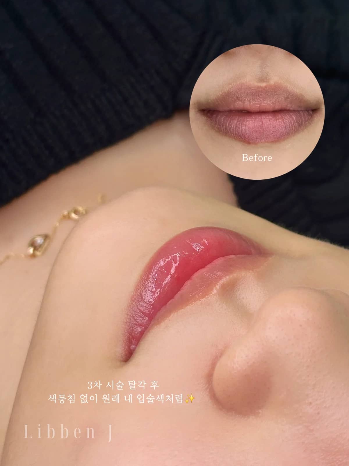 그라데이션립 탈각후
