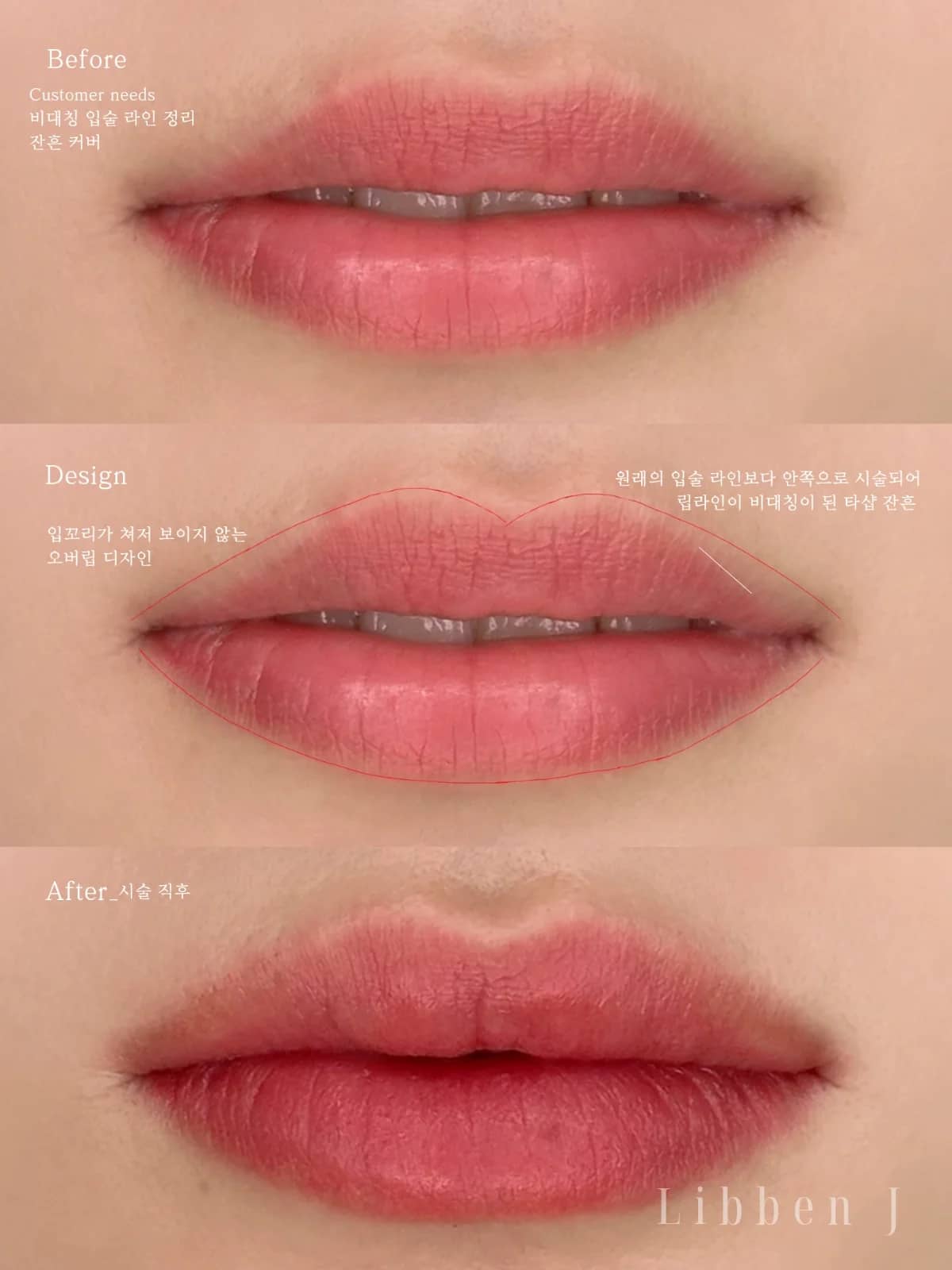 오버립+컬러